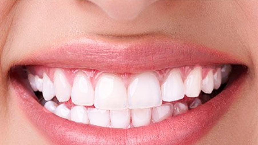 ​​Aparaty ortodontyczne Staszów - Świętokrzyskie efekty leczenia