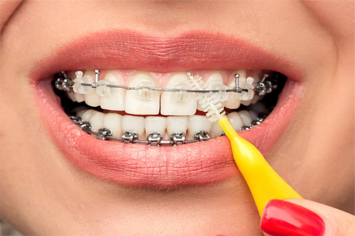 Troska o higienę Aparaty ortodontyczne Staszów  Świętokrzyskie