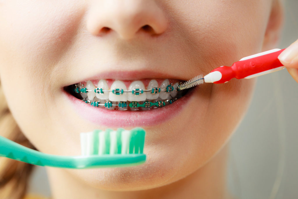 Utrzymanie higieny Aparaty ortodontyczne Staszów  Świętokrzyskie