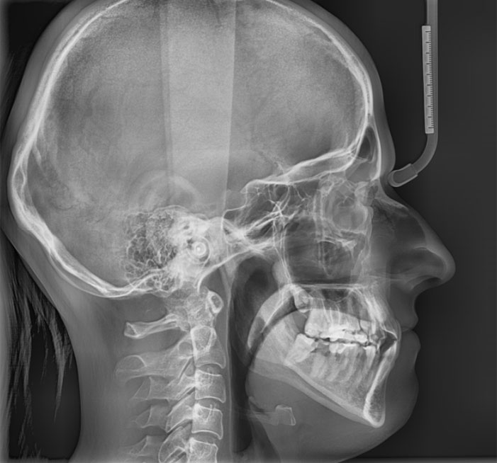 ​Ortodonta Staszów Świętokrzyskie Diagnostyka  Cefalometria