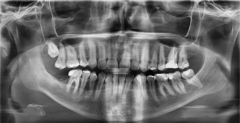 ​Ortodonta Staszów Świętokrzyskie Diagnostyka PA czaszki