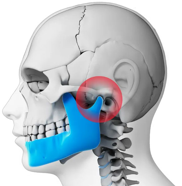 ​​Ortodonta Staszów​ Świętokrzyskie Staw skroniowo-żuchwowy - model