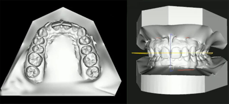 ​​Ortodonta Staszów Świętokrzyskie Skaner ortodontyczne, modele cefrowe 3D