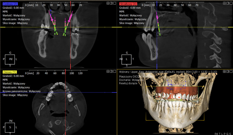 ​​Ortodonta Staszów Świętokrzyskie Skaner ortodontyczne, modele cefrowe 3D