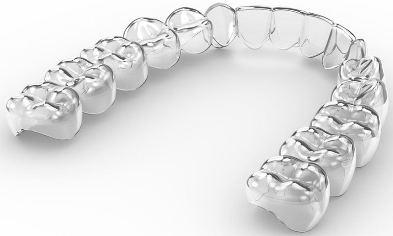 ​Aparaty ortodontyczne Staszów  - Świętokrzyskie Aparaty ruchome
